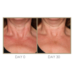 Dream Cream Moisturizing Treatment